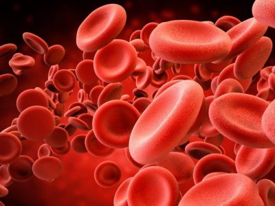 10 sinais e sintomas de anemia por deficiência de ferro