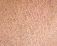 Pele seca no inverno: 7 dicas para uma pele saudável